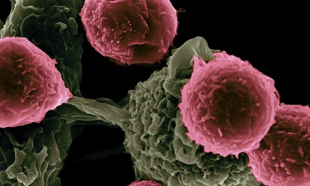 Peste 1 milion de cazuri de cancer nediagnosticate în Europa din cauza pandemiei